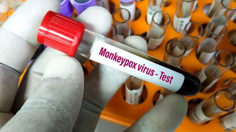 Monkeypox Monkeypox
