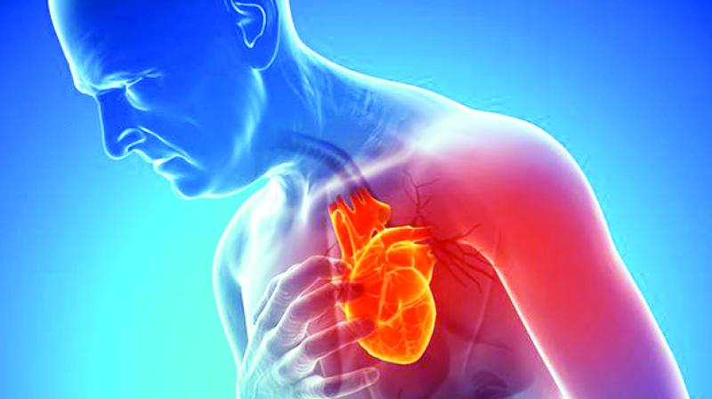 Heart Disease Heart Disease
