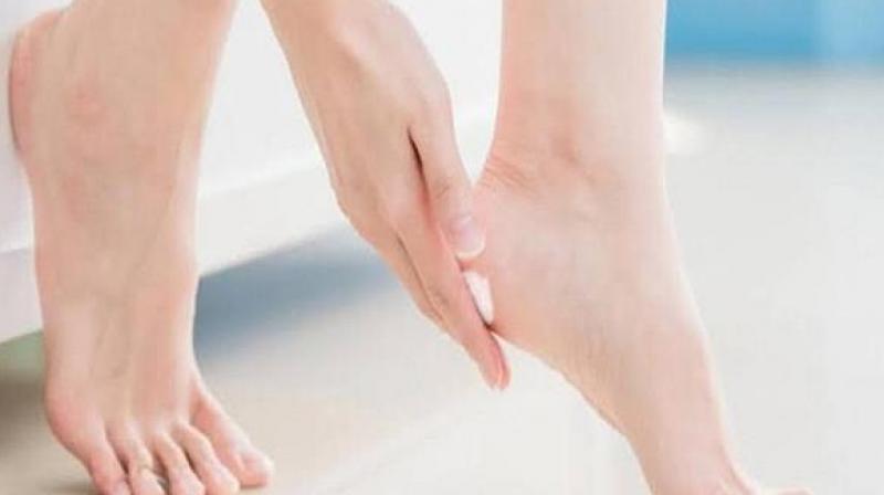 Heal Cracked Ankles Heal Cracked Ankles