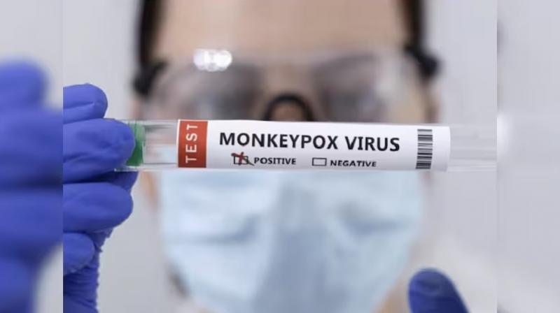 Monkeypox is spreading rapidly around the world Monkeypox is spreading rapidly around the world