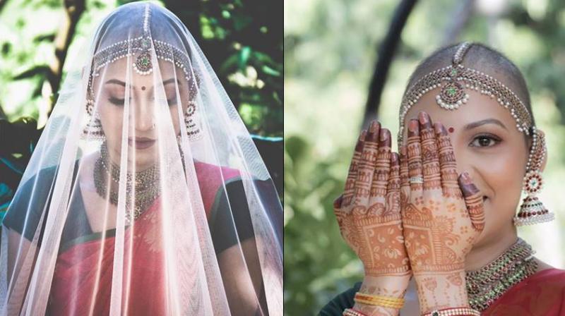 Hair with cancer, people around the world like this pictures of this bride