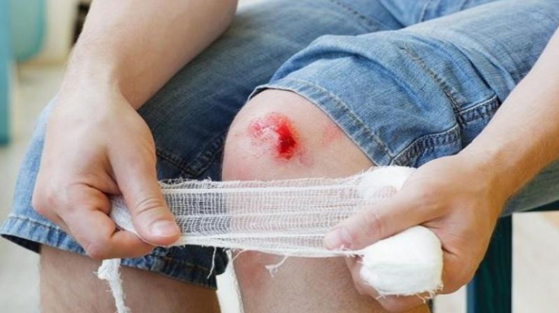 If you get injured, these home remedies will help heal the wound If you get injured, these home remedies will help heal the wound
