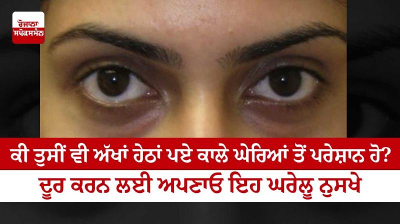 Are you also bothered by dark circles under your eyes? Are you also bothered by dark circles under your eyes?
