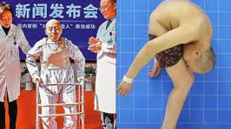 Li Hua Li Hua