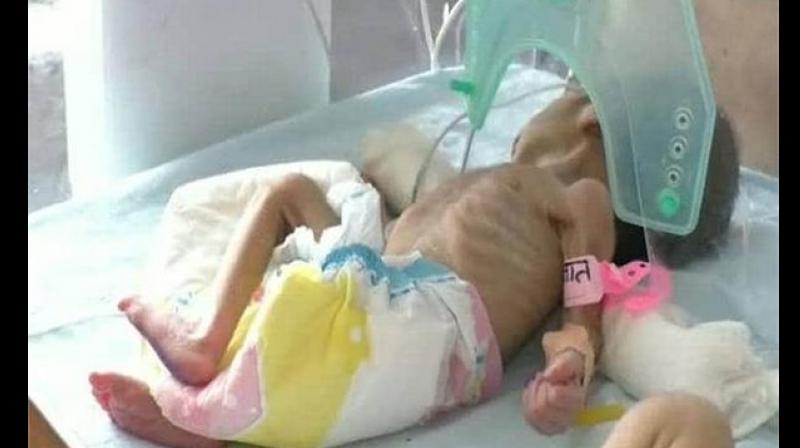 Bareilly Newborn Baby Bareilly Newborn Baby