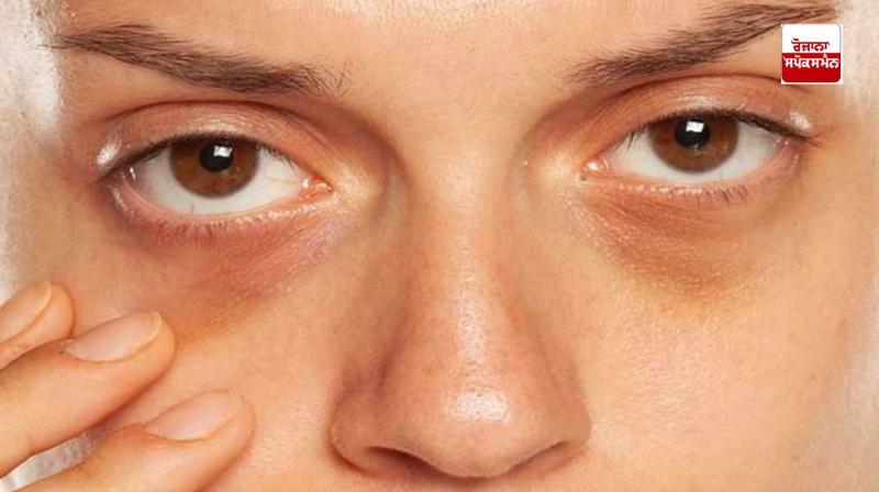 Follow this recipe to remove dark circles under the eyes Follow this recipe to remove dark circles under the eyes