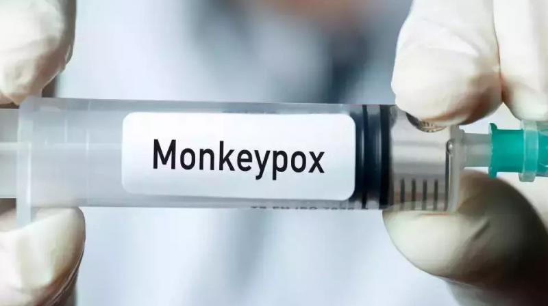 monkeypox 