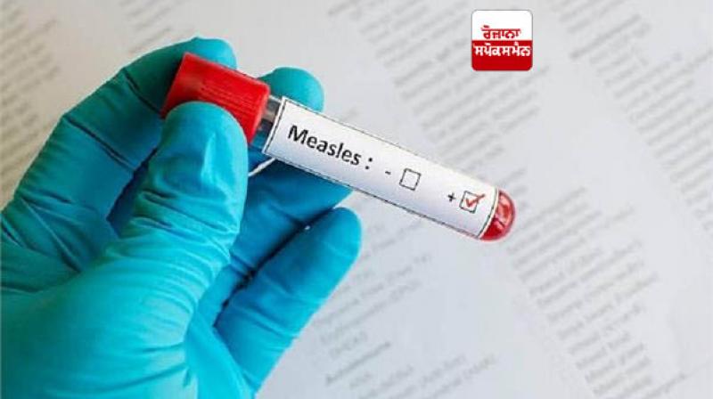 Measles outbreak continues in various provinces of Pakistan Measles outbreak continues in various provinces of Pakistan