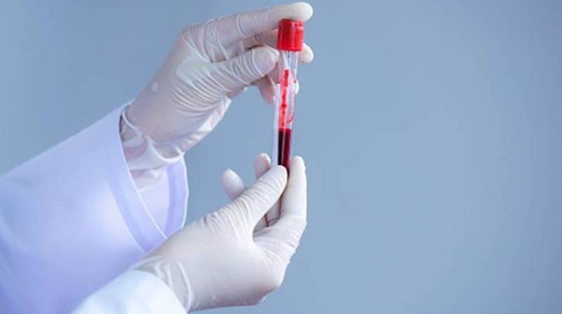 Corona Virus Corona Virus