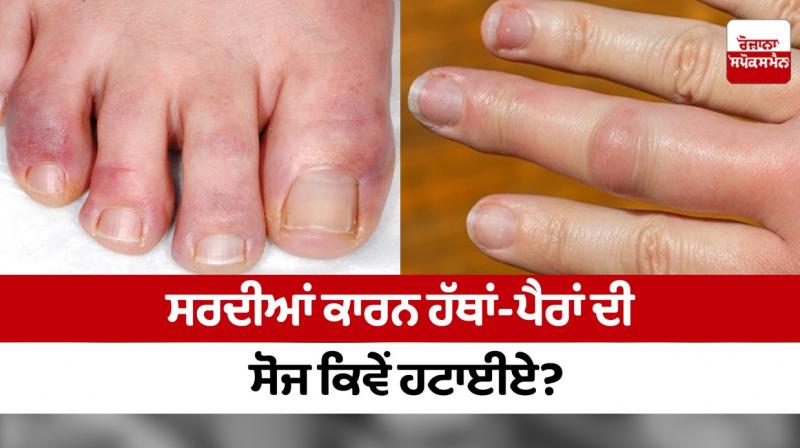 How to remove swelling of hands and feet due to winter? How to remove swelling of hands and feet due to winter?