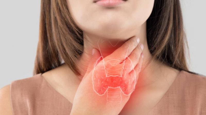 Thyroid Thyroid