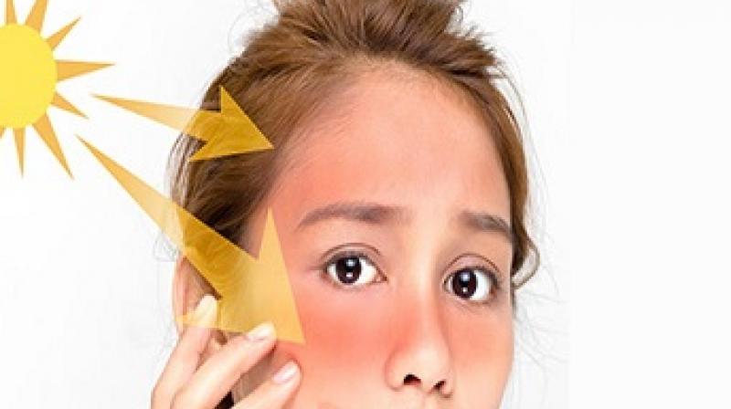 Home remedies for tanning Home remedies for tanning