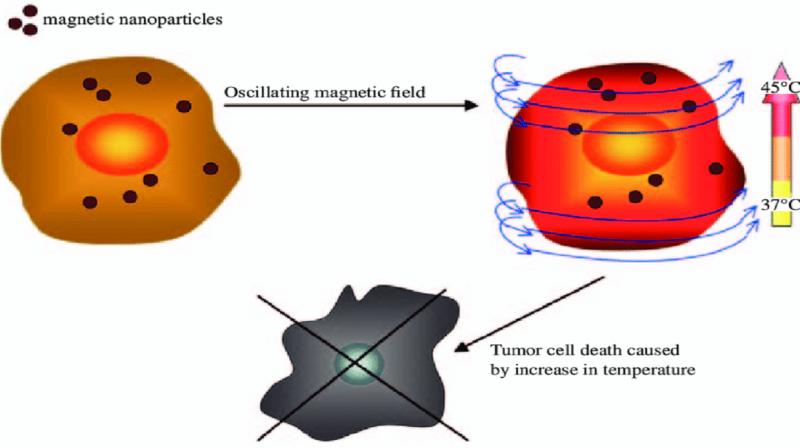 Magnetic Fluid Hyperthermia technology