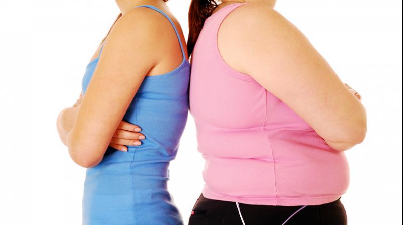 Obesity in women Obesity in women