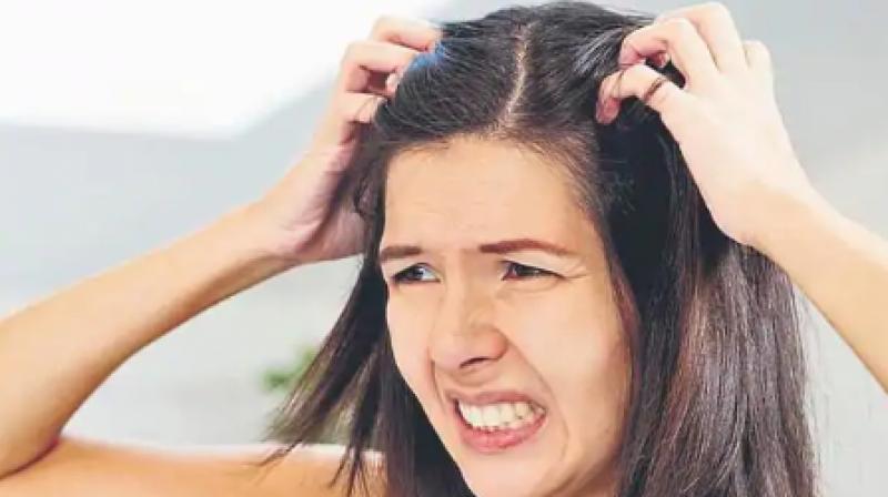 Itchy Scalp Itchy Scalp