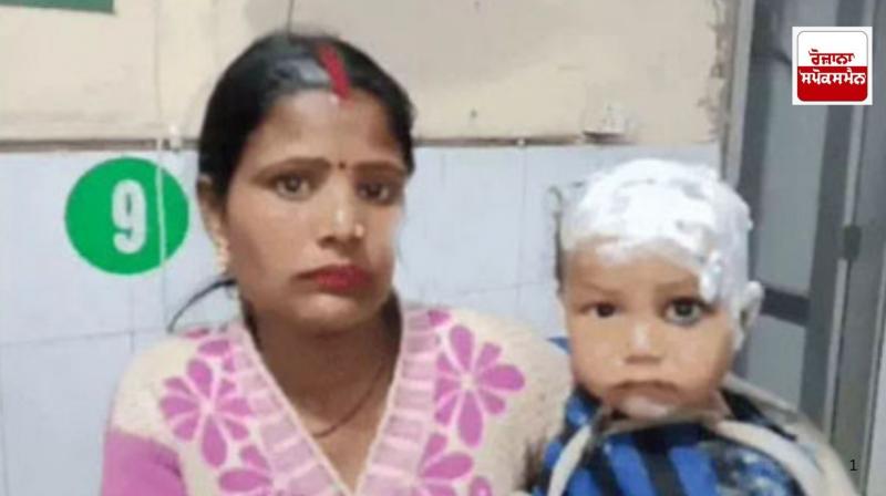 One and a half year old girl burnt by hot dal in Ludhiana One and a half year old girl burnt by hot dal in Ludhiana