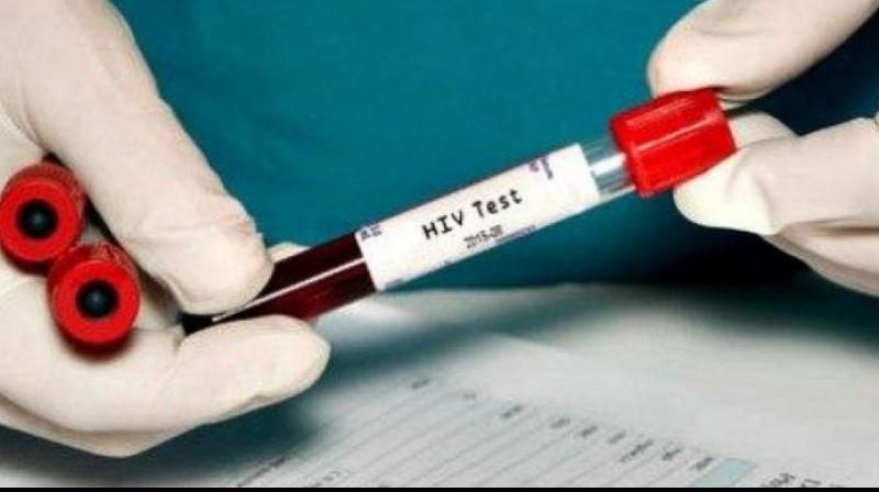 HIV HIV