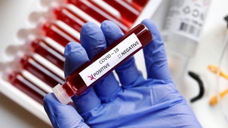 Corona Virus Corona Virus