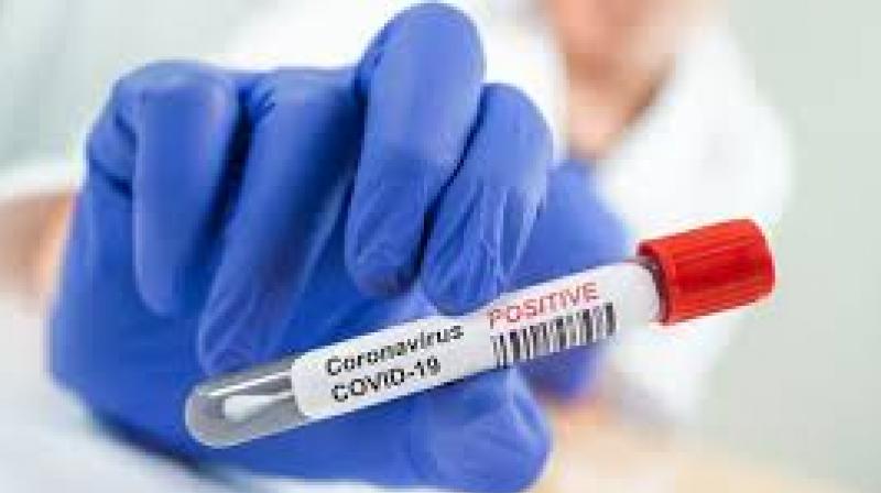 Corona Virus Corona Virus