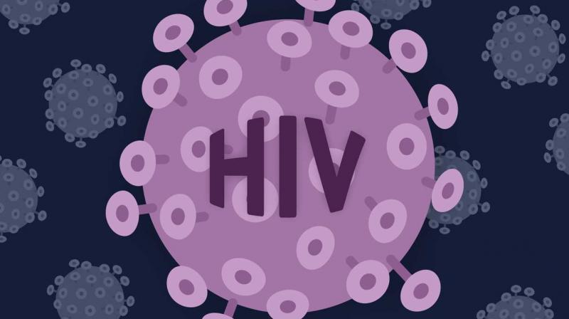 HIV HIV
