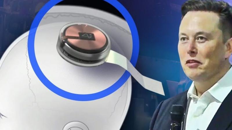 Musk's brain implant company 'Neuralink' nears human trials Musk's brain implant company 'Neuralink' nears human trials