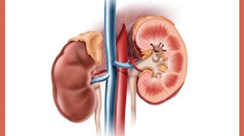 Kidney 