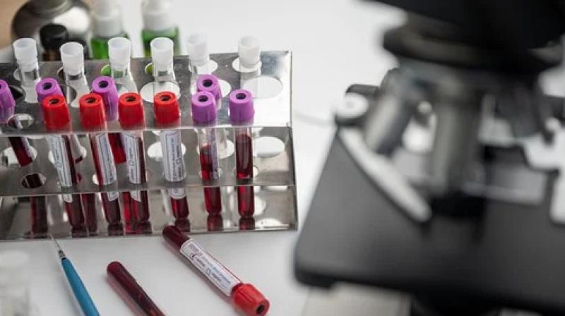 Glenmark pharma gets dcgi nod for clinical trials of favipiravir tablets on covid 19 Glenmark pharma gets dcgi nod for clinical trials of favipiravir tablets on covid 19