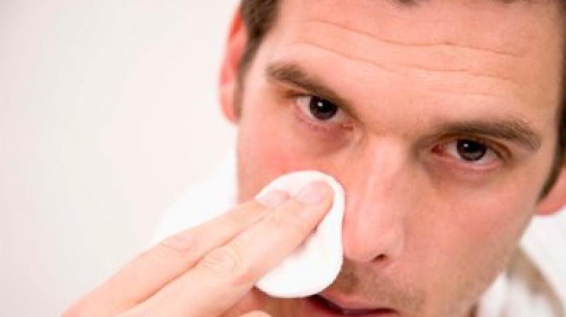 dry nose dry nose