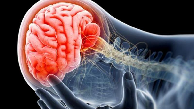Panic disorder Panic disorder