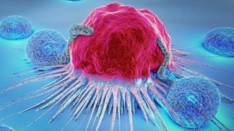 Tumour Tumour