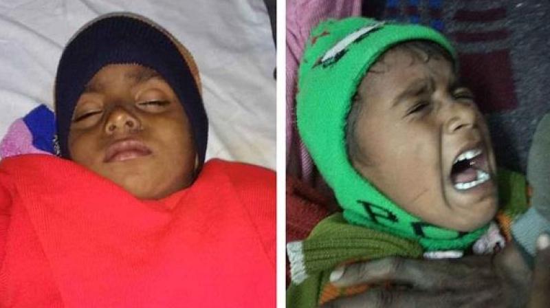 Children sick Children sick