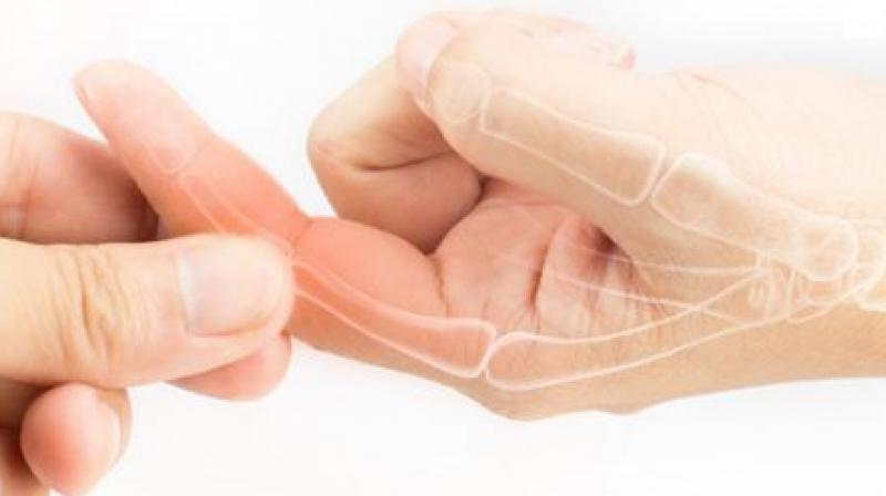 hand swelling problem hand swelling problem