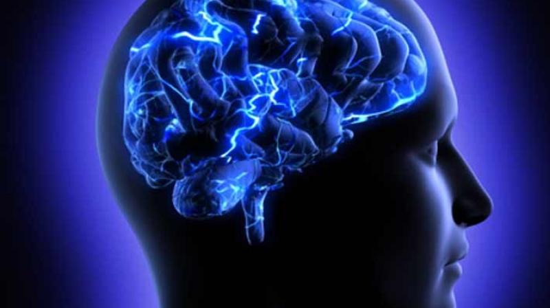 Brain dead Brain dead