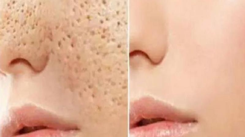 Skin Skin