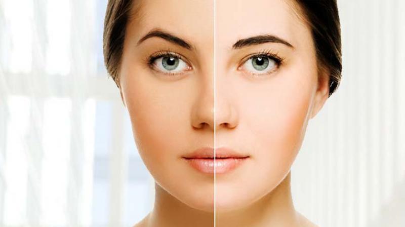 Fair Complexion Fair Complexion