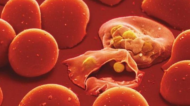 Malaria Malaria