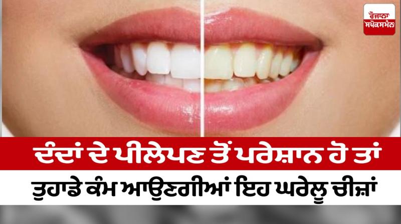 If you are worried about the yellowness of your teeth then these home remedies will come in handy If you are worried about the yellowness of your teeth then these home remedies will come in handy