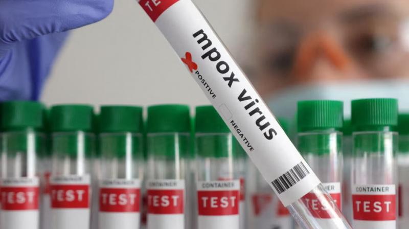 India need not fear Mpox virus, use these precautions India need not fear Mpox virus, use these precautions