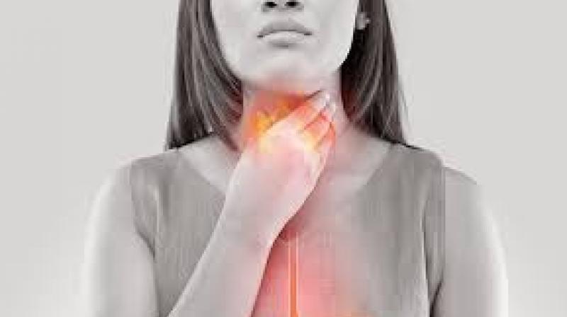 Esophagal Cancer Esophagal Cancer