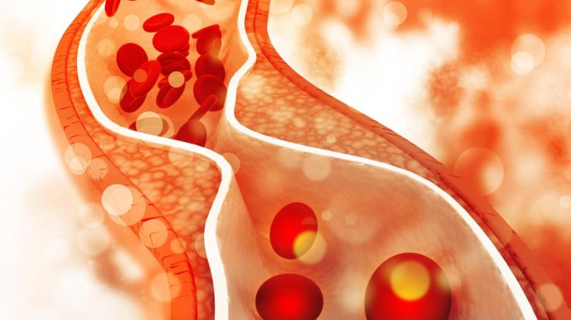 Even at a young age there can be a risk of high cholesterol, do not ignore these signs Even at a young age there can be a risk of high cholesterol, do not ignore these signs