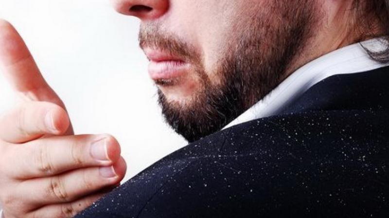 dandruff dandruff