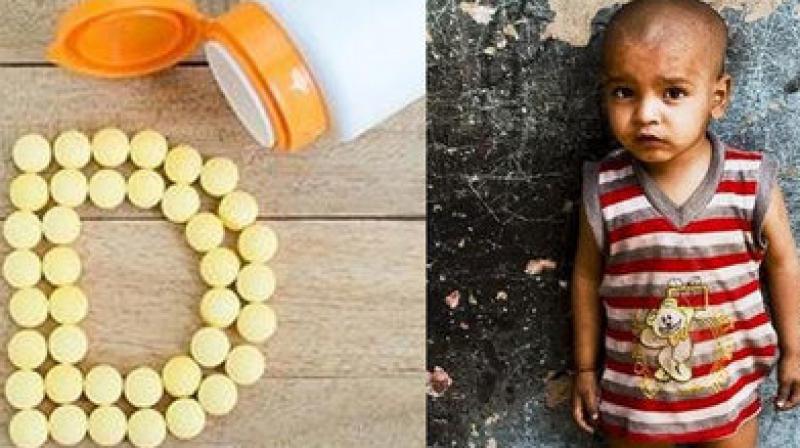 Vitamin D can improve the Malnutrition Vitamin D can improve the Malnutrition