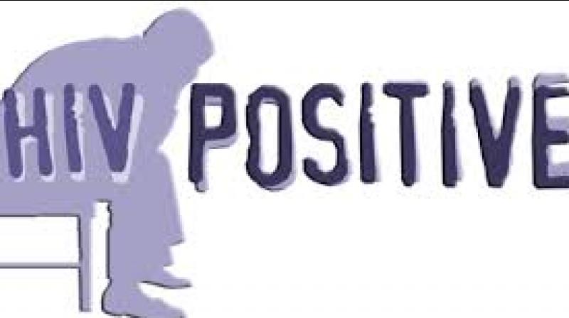 HIV positive HIV positive