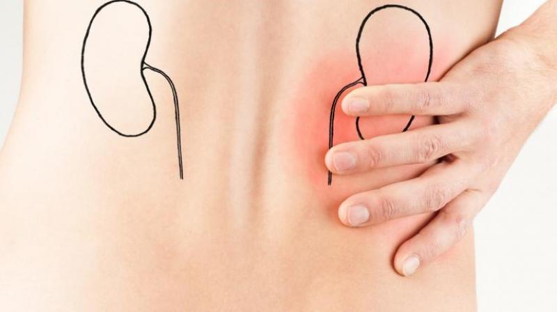 Kidney Cancer Signs Kidney Cancer Signs