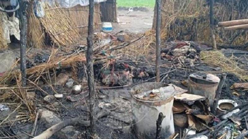 Ludhiana slum fire case, 2 more children died during treatment Ludhiana slum fire case, 2 more children died during treatment