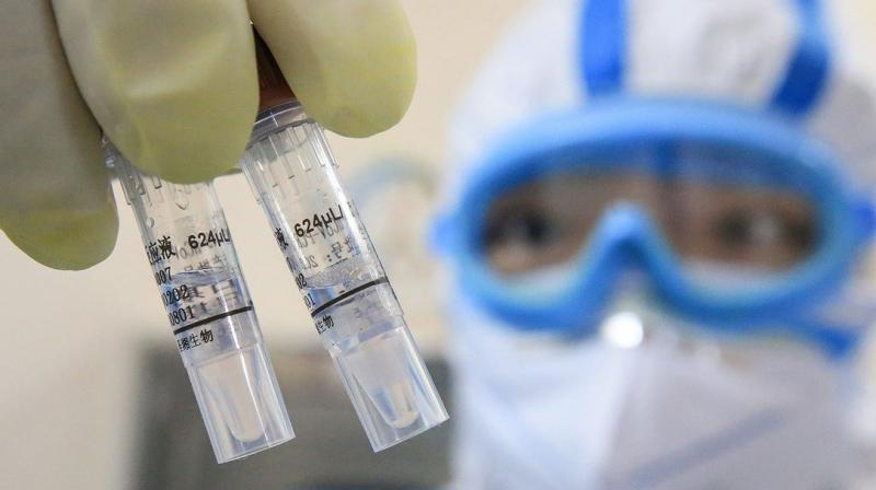 Corona virus was not a biological weapon: American intelligence agencies Corona virus was not a biological weapon: American intelligence agencies