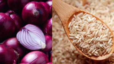 Representative Image.