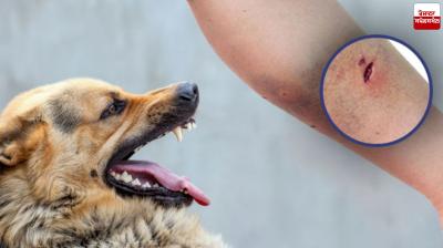 10,000 People Are Killed by Dogs Everyday in India : TOI Report Latest News in Punjabi