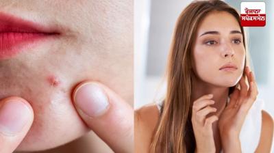 Women can also improve their skin with household items instead of external items, let's know how.