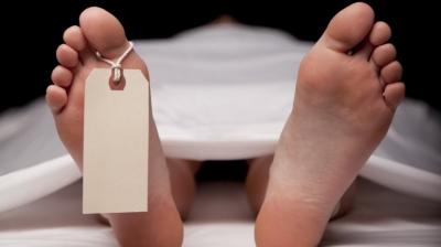 Representative Image.